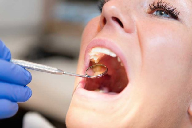 oral cancer screening